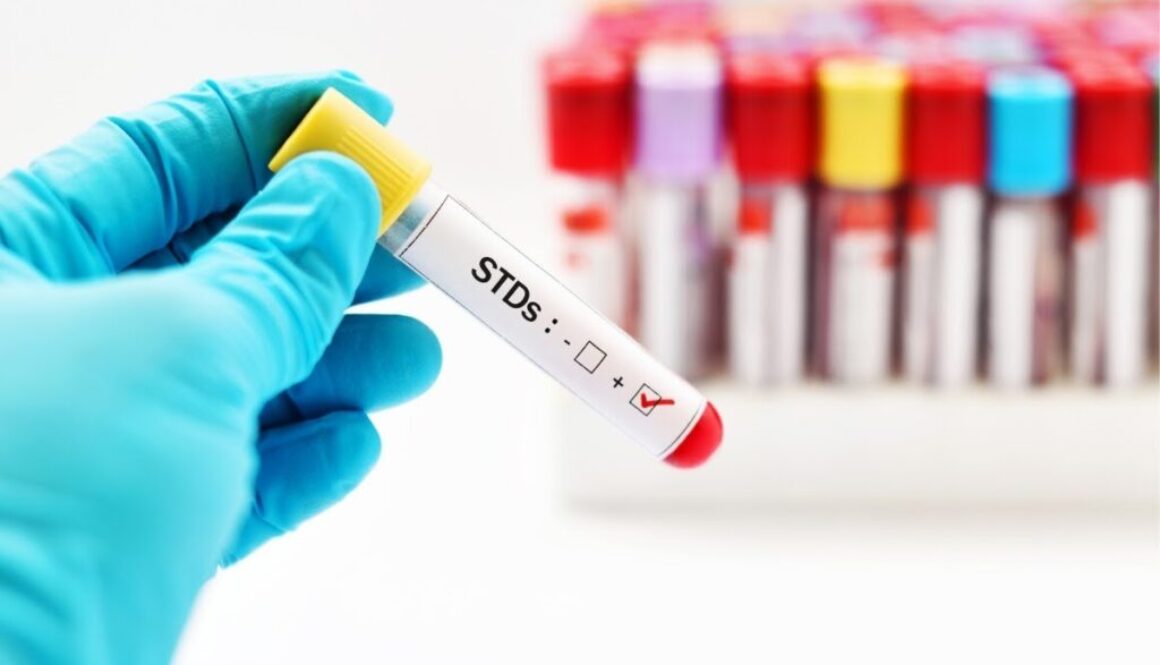 A picture of STD lab results